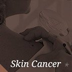 Skin Cancer