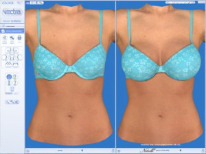 VECTRA 3D Imaging New Jersey NJ